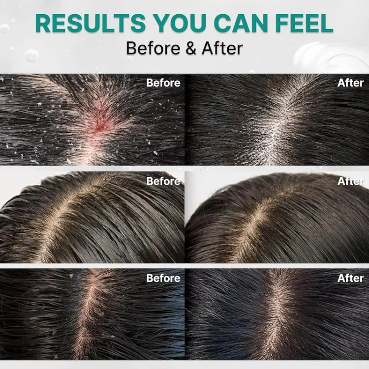شامپو جوانساز و ترمیم کننده و پاککننده عمیق پوست سر لیلیوئه Shampoo Lilyeve Scalp:Turn Cica PDRN Deep Clean 500 g