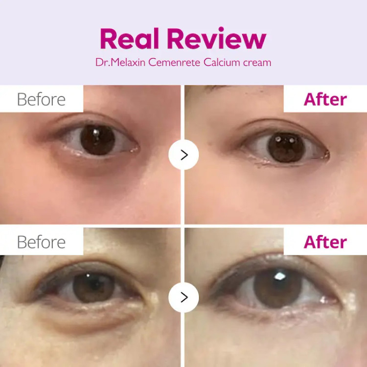 كرم ضد چروک و حجم دهنده كلسيم دكتر ملاكسين Dr.Melaxin Cemenrete Calcium Volume Cream