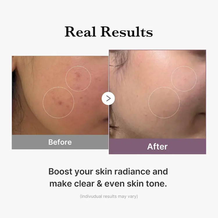 تونر گلوتاتیون مدیکوب روشن کننده و جوانساز پوست Medicube AGE-R Glutathione Glow Toner